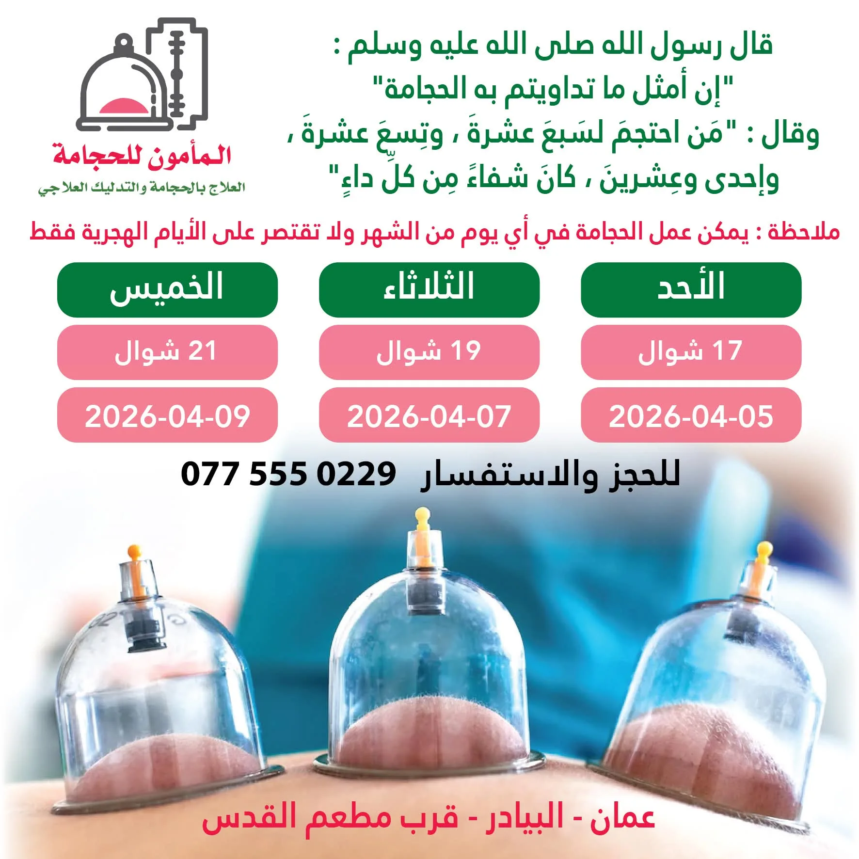 حجامة